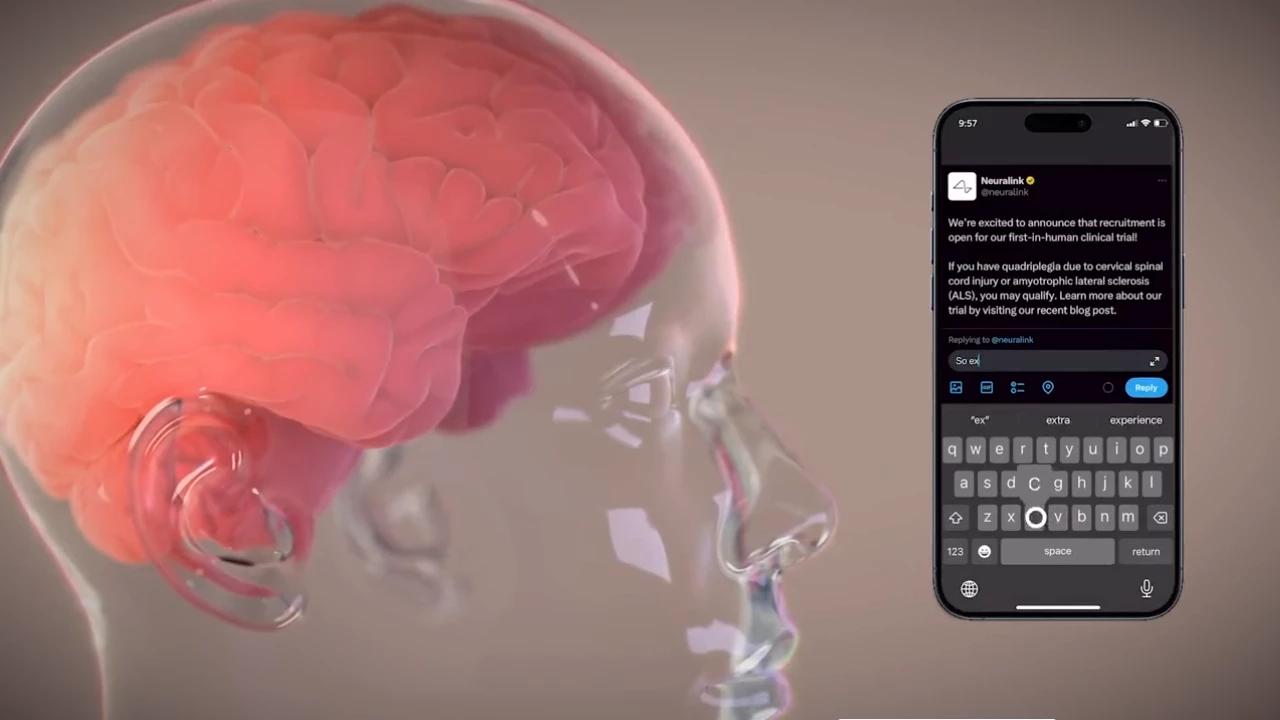 ¿Se puede hackear un chip cerebral?: esto dice el primer paciente de Neuralink
