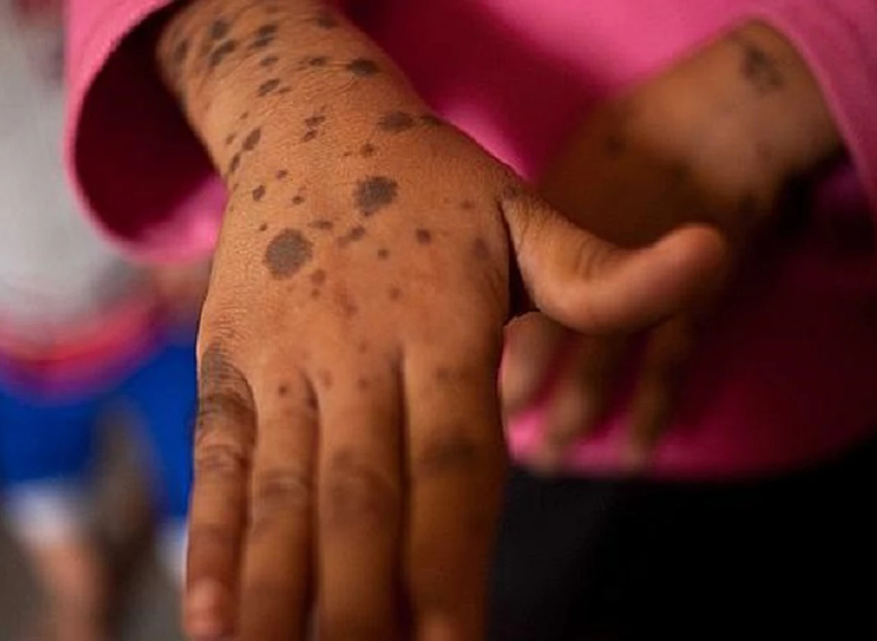 El Chaco del que no se habla: Avia Terai, un pueblo que vive envenenado por las fumigaciones