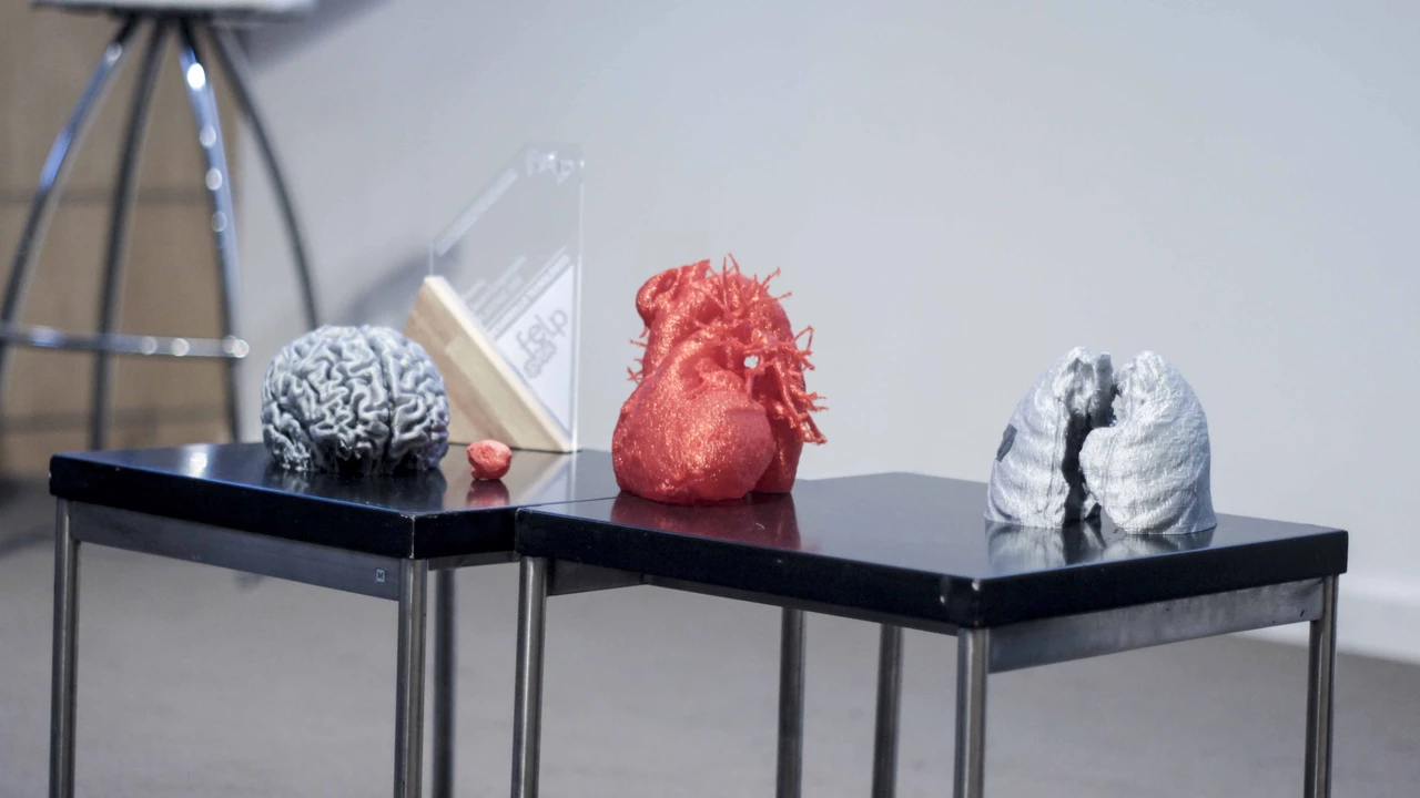 Esta startup imprime órganos en 3D para que los médicos sean más precisos en sus cirugías