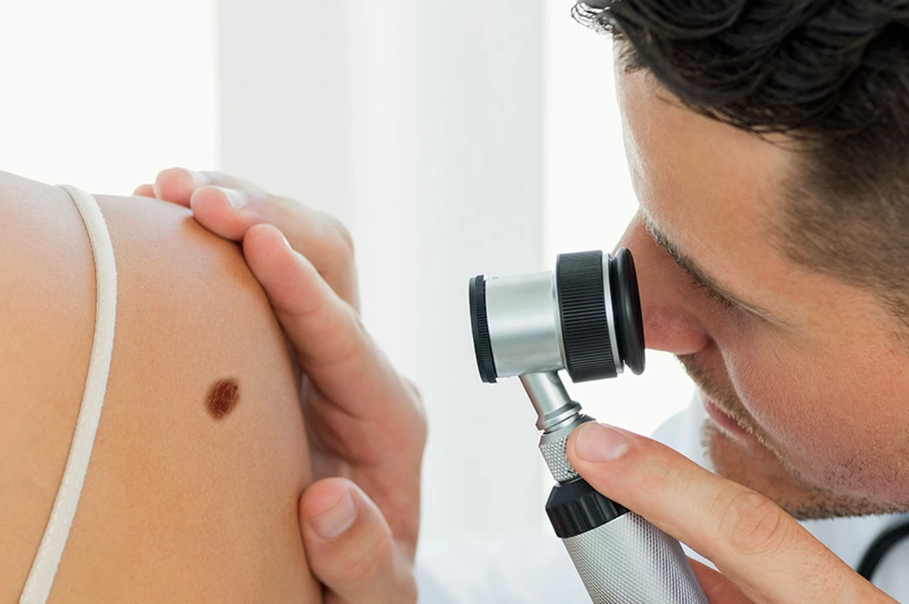 Todo lo que debés saber para evitar los riesgos de padecer enfermedades de la piel