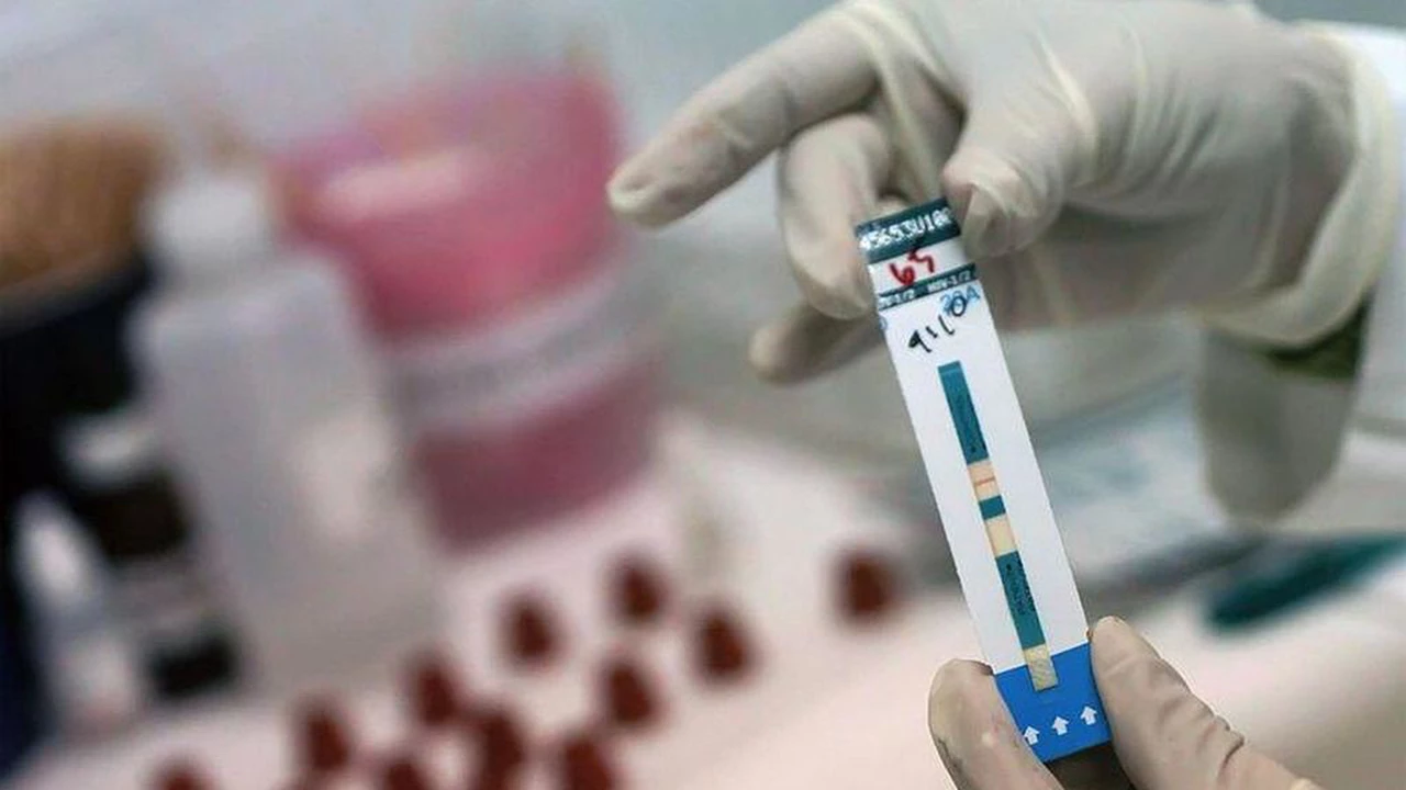 Un test que puede salvar vidas: conocé cómo funciona la prueba rápida de VIH