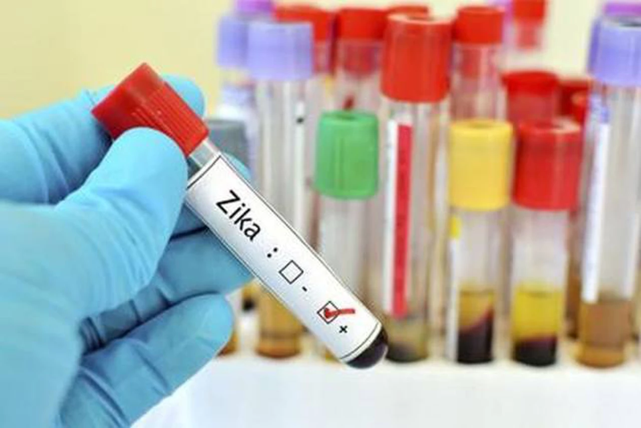 ¿Una enfermedad podría proteger a los niños del virus zika?: un estudio confirmaría esta hipótesis