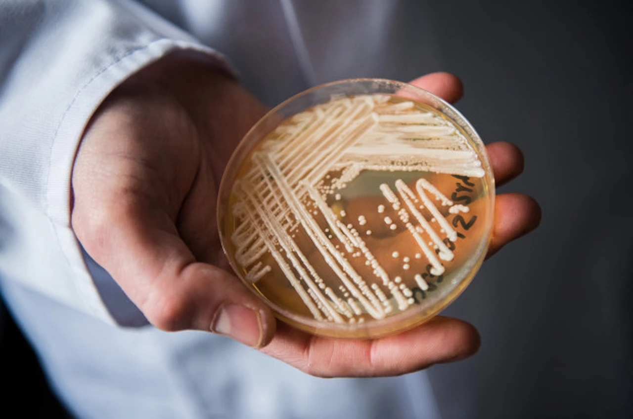 Candida auris: el hongo mortal que se propaga en los hospitales