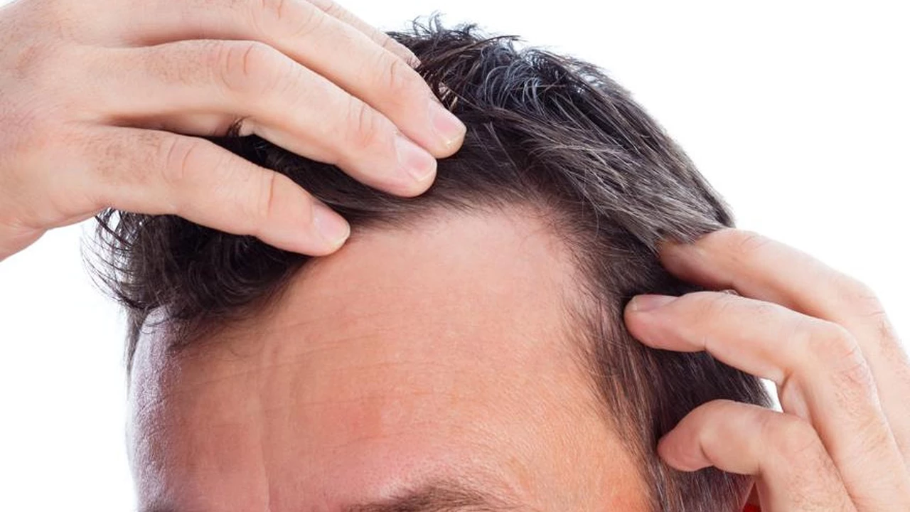 Caída del pelo: ¿realmente sirven los champús, lociones y vitaminas para evitarla?