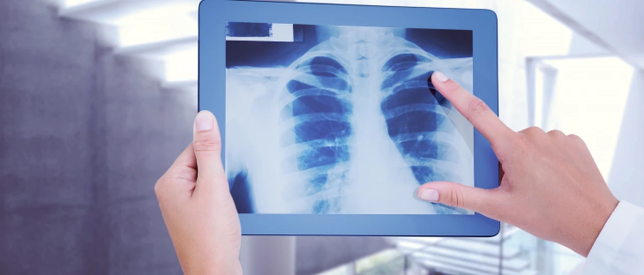 Por qué se celebra hoy el Día de la Radiología y por qué es tan importante