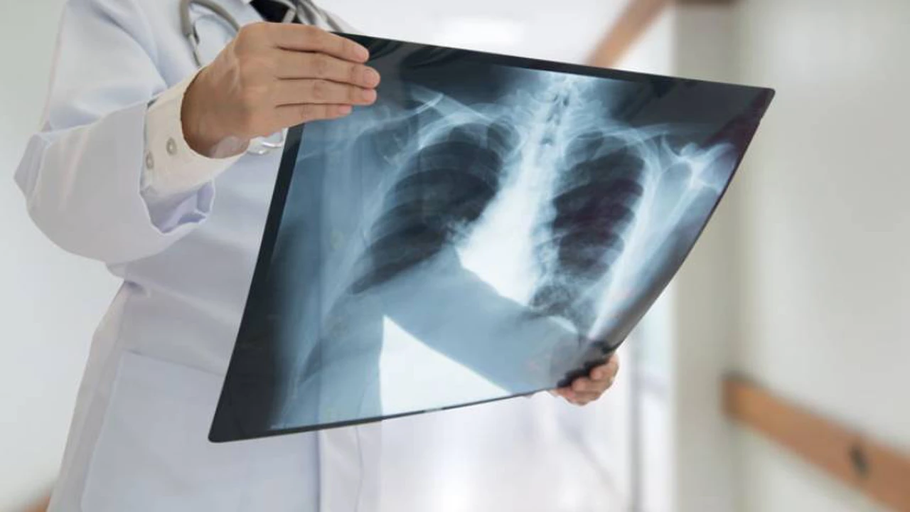 Cuánto cuesta hacerse una radiografía en 2022