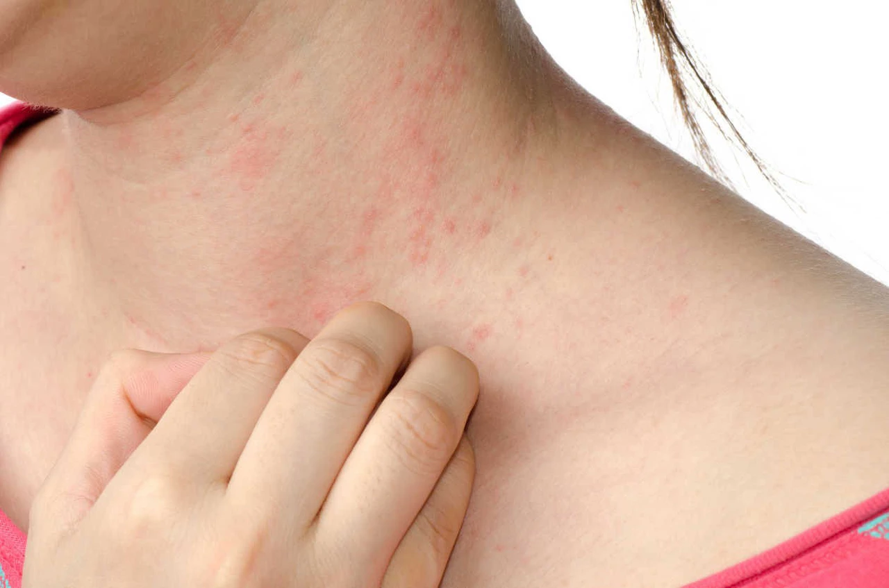 Manchas rojas en la piel: ¿qué son y qué trastornos pueden causarlas?