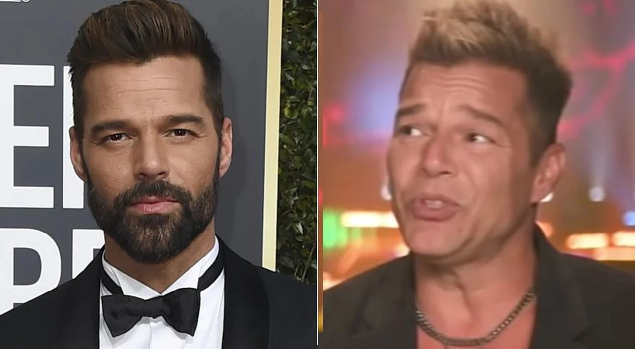Ricky Martin se habría retocado la cara y lo compararon con otros famosos