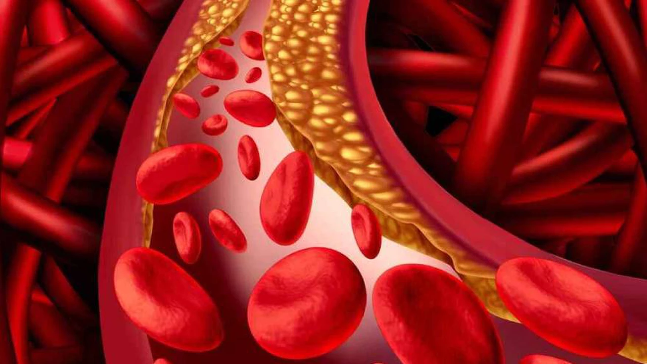 Lanzan un nuevo medicamento para colesterol que previene eventos vasculares sin efectos adversos musculares