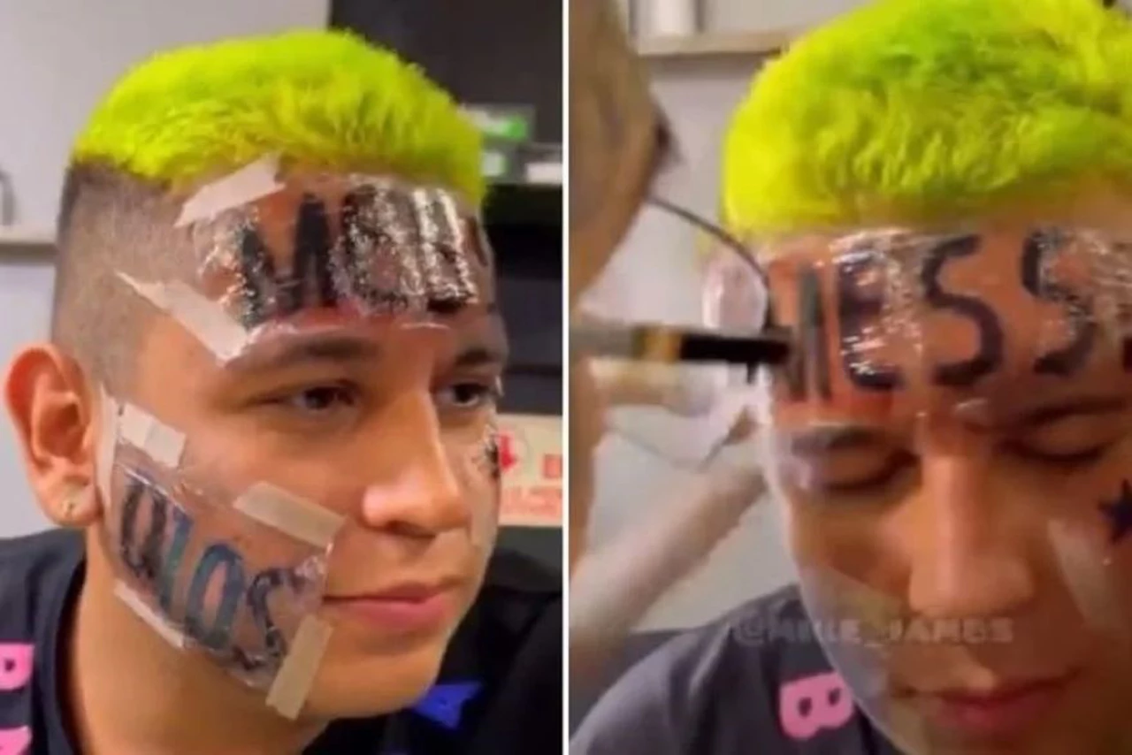 Viral: un joven se tatuó "Messi" en la frente tras la final del Mundial y ahora se lo quiere borrar