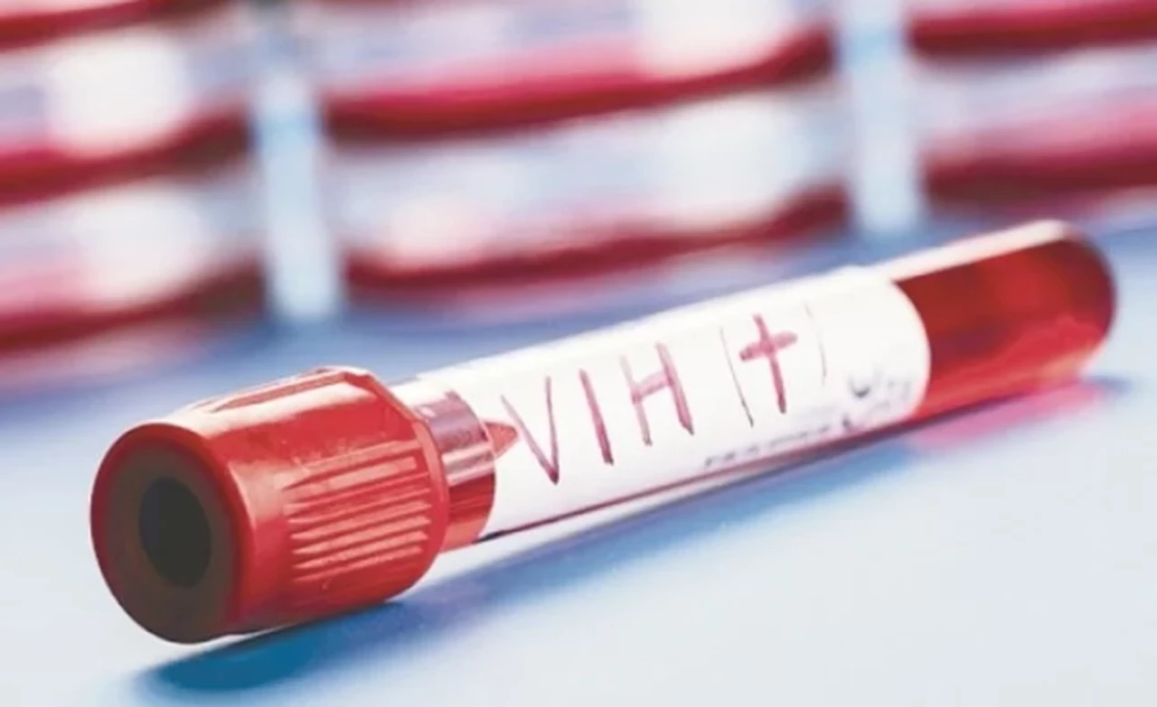 Pruebas de VIH: cómo son los tests hoy en día y dónde se pueden hacer