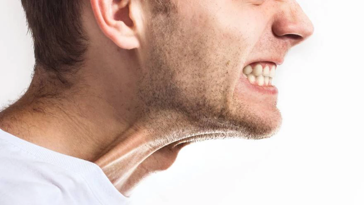 El síndrome de los "dientes rotos": por qué el coronavirus disparó el bruxismo y otros problemas dentales