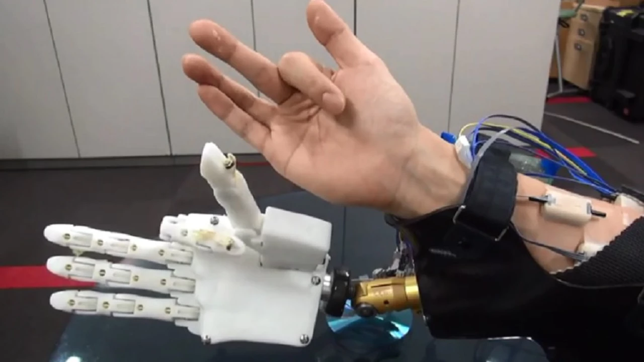 Crean una prótesis de mano que se mueve por completo gracias a la inteligencia artificial