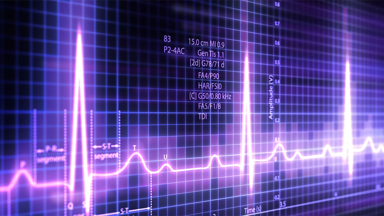 Inteligencia artificial y nuevo avance en la salud: un electrocardiograma puede predecir si vas a morir