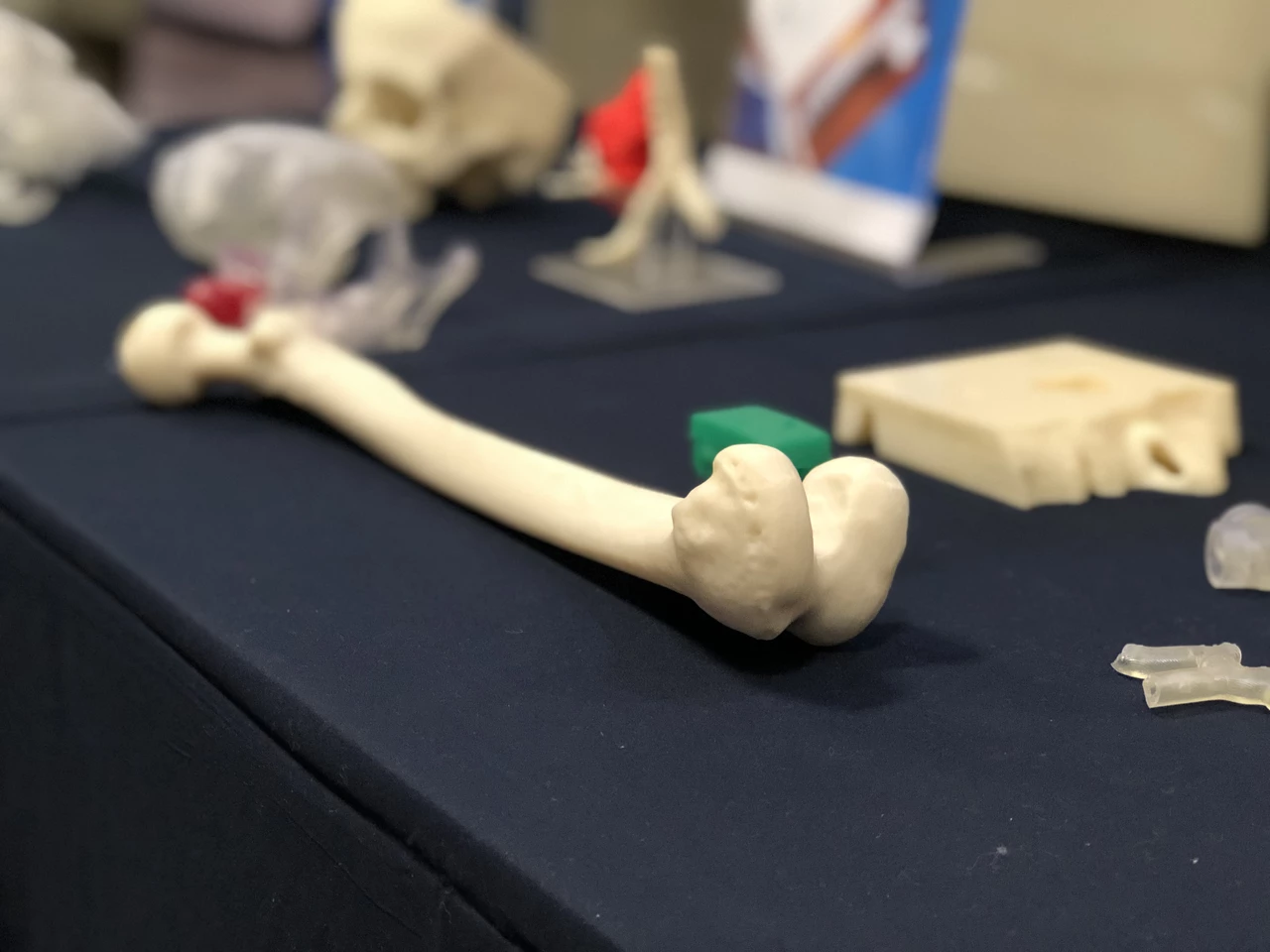 De BlackMirror: una impresora 3D ya crea huesos para usar dentro del cuerpo del paciente