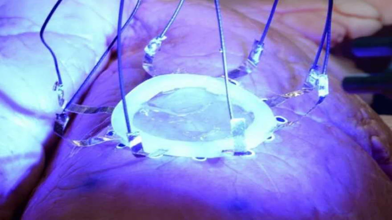 Salud 4.0: desarrollan un sensor que puede ser colocado en un órgano interno vía impresión 3D