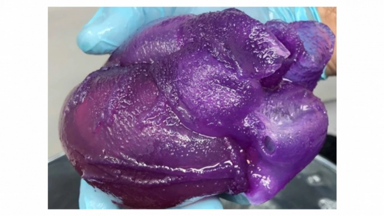 Avance científico: se crea el primer corazón a tamaño real con bioimpresión 3D