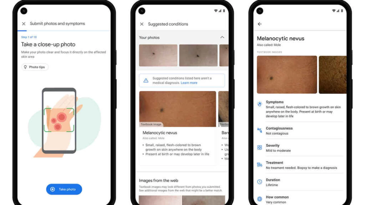 ¿Tenés problemas en la piel?: la nueva herramienta de Google te permitirá saber exactamente qué te pasa