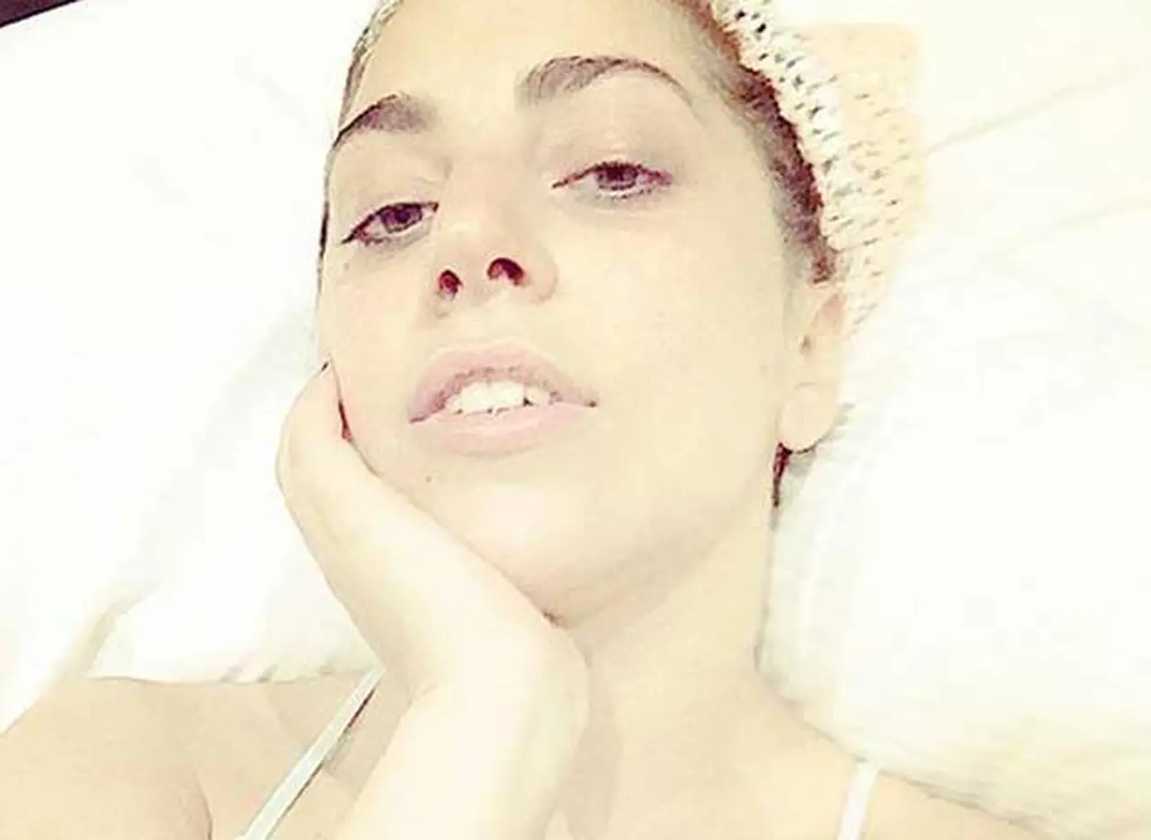 Las fotos de Lady Gaga en Instagram sin maquillaje que generaron polémica