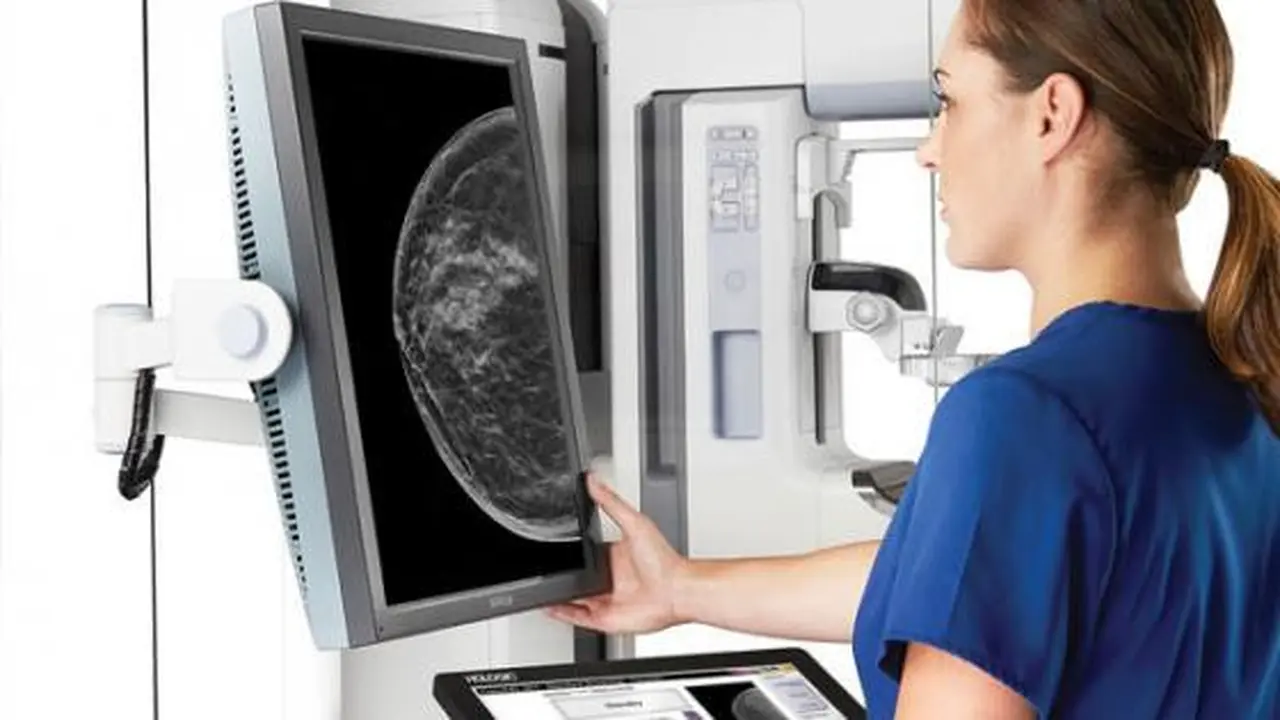 ¿Qué factores de riesgo pueden predisponer a la aparición del cáncer de mama?