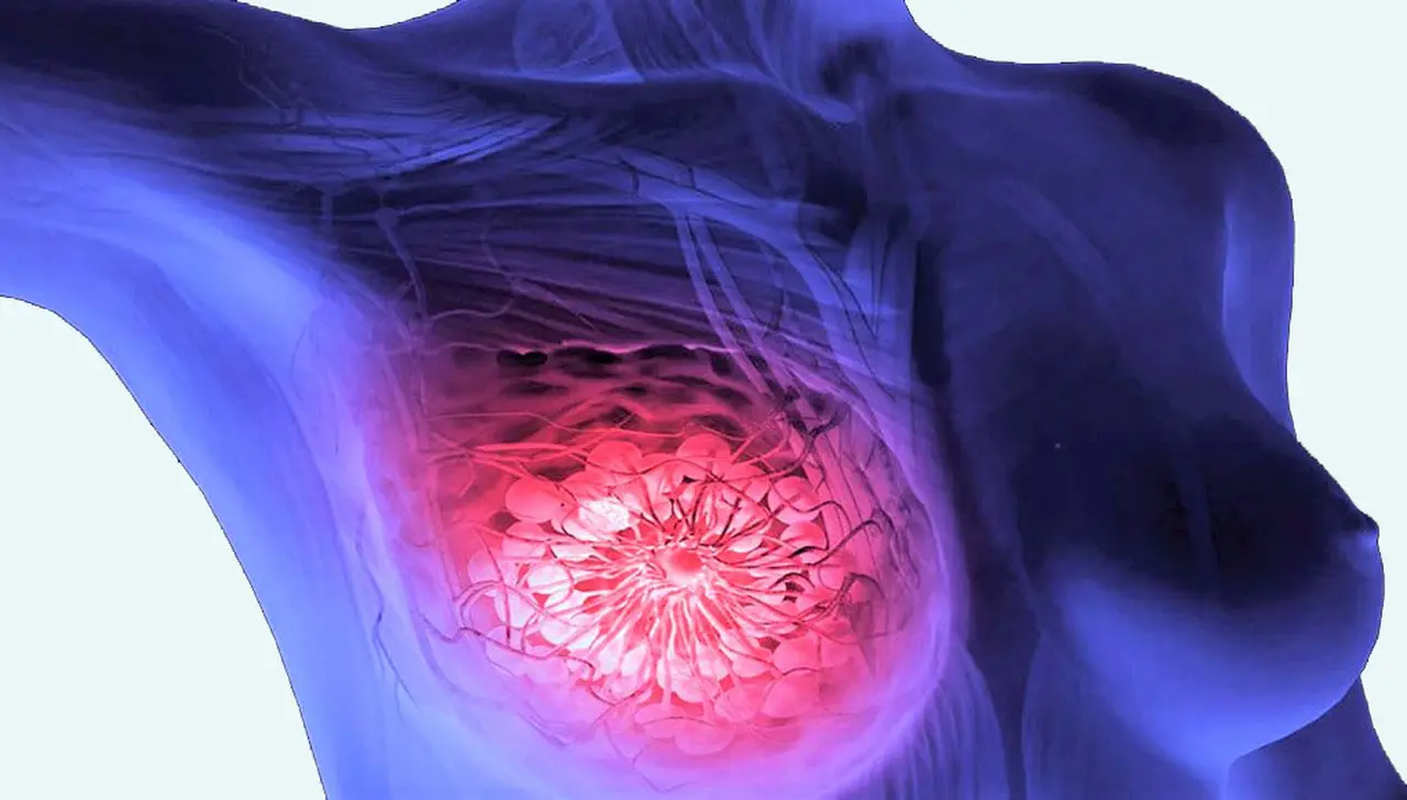 El consumo de ciertas frutas podría ayudar a prevenir algunos tipos de cáncer