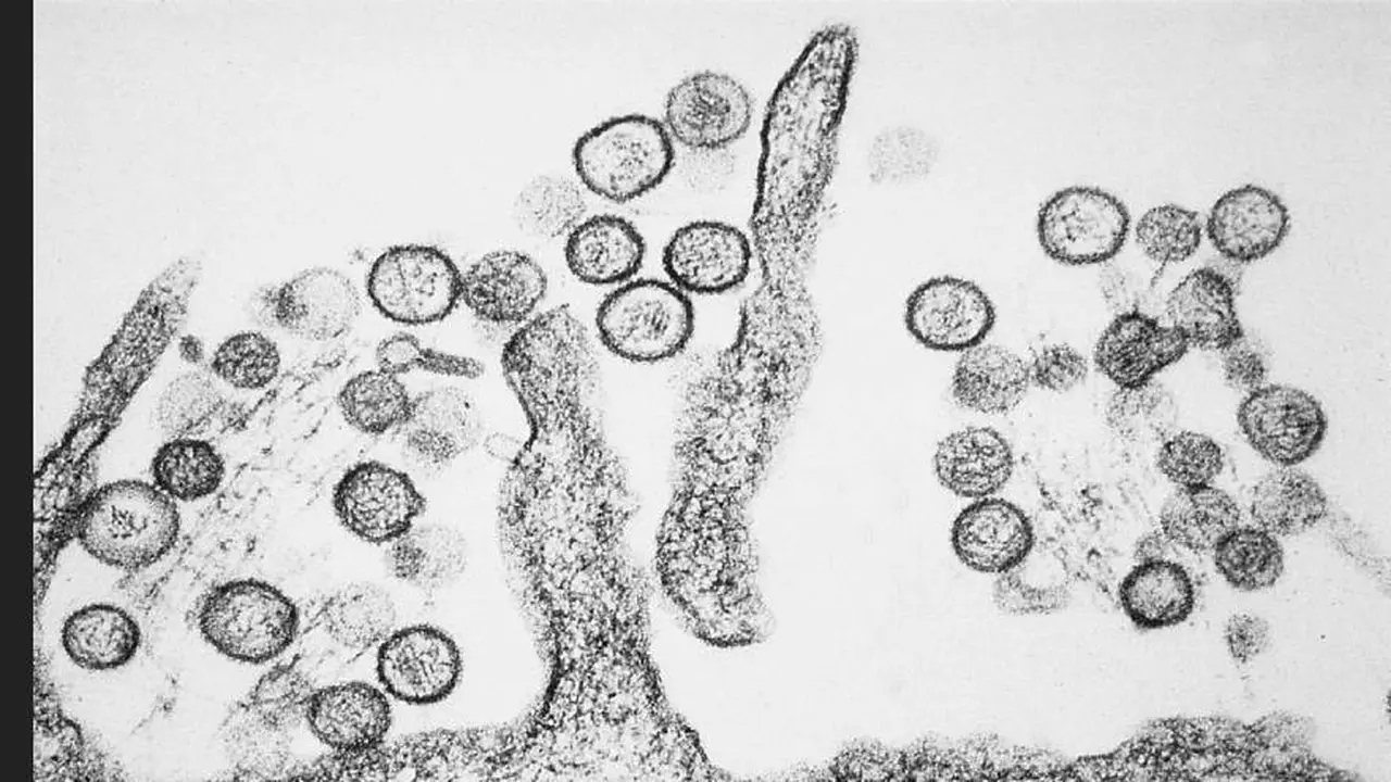 Así se ve el hantavirus bajo un microscopio