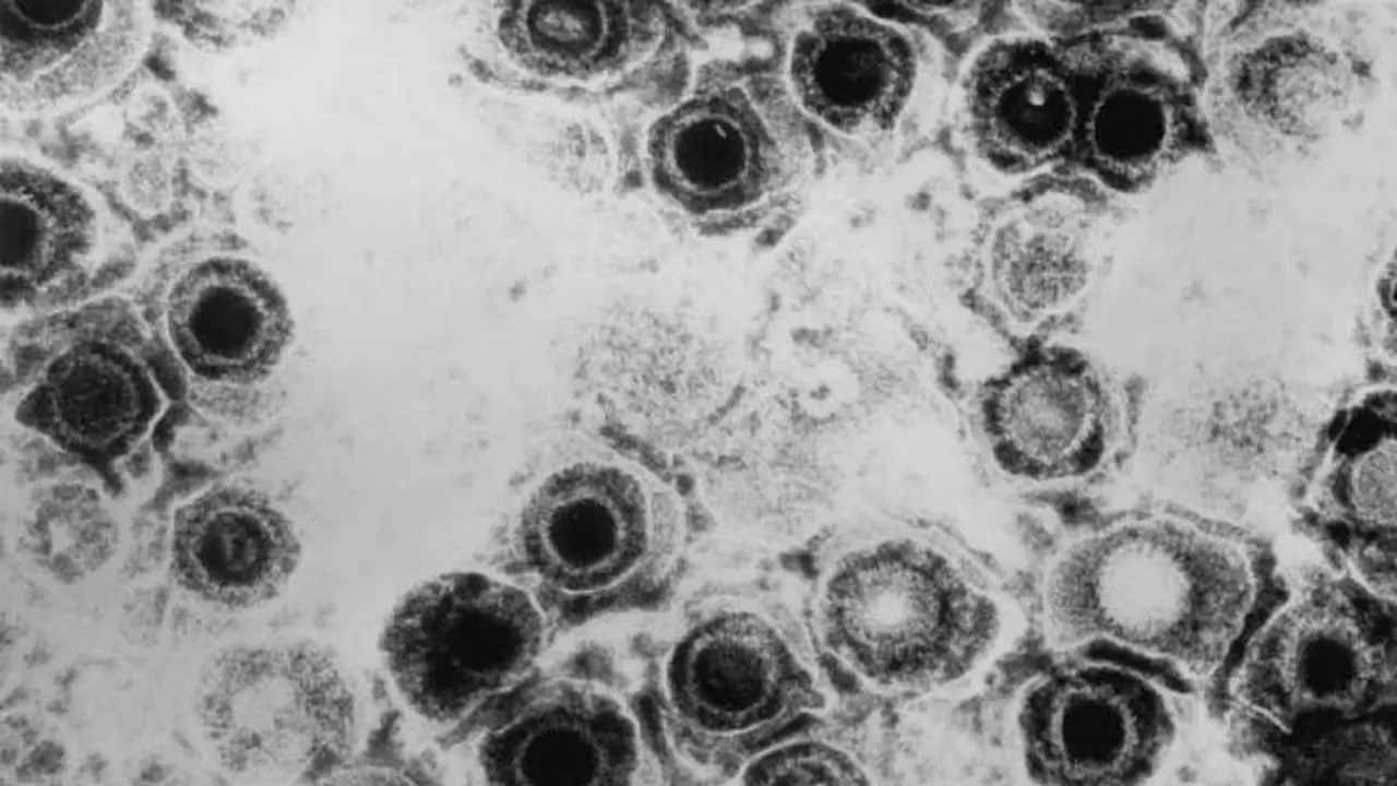 Así se ve el virus herpes