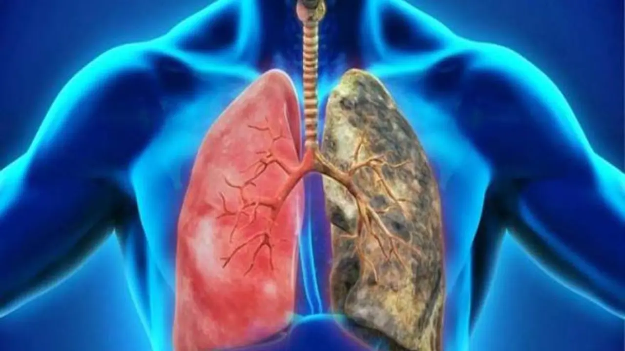 El Covid-19 puede dejar secuelas a nivel pulmonar