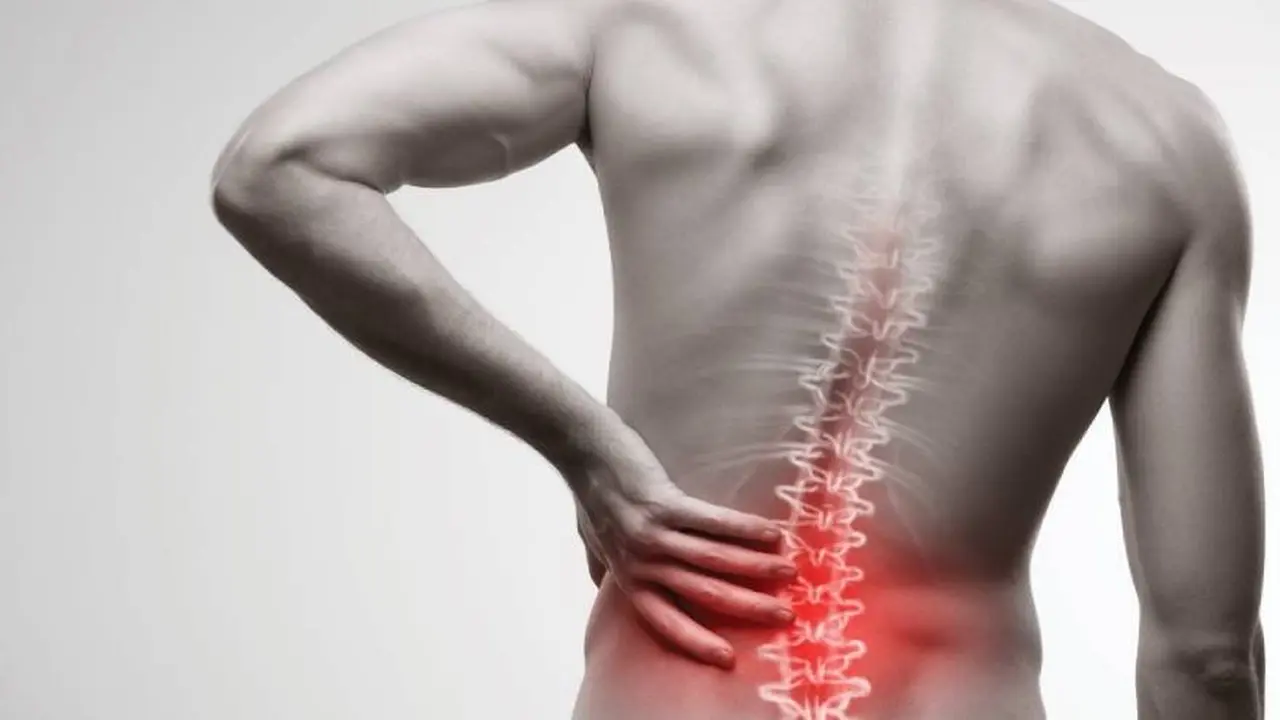 La hernia de disco puede afectar severamente la salud