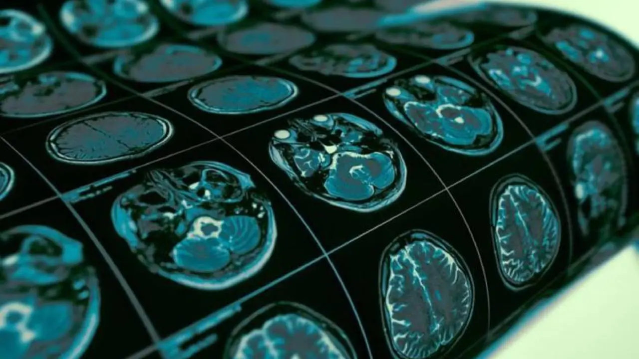 La capacidad cerebral puede aumentar cuando se practica ejercicio