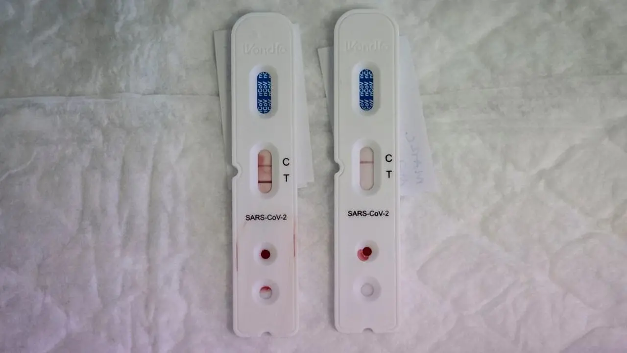 Los test de PCR determinan si la persona tiene coronavirus