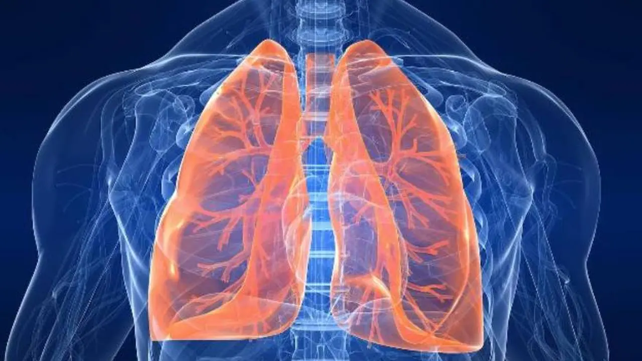 El Covid-19 puede presentar, al igual que otras enfermedades, compromiso pulmonar