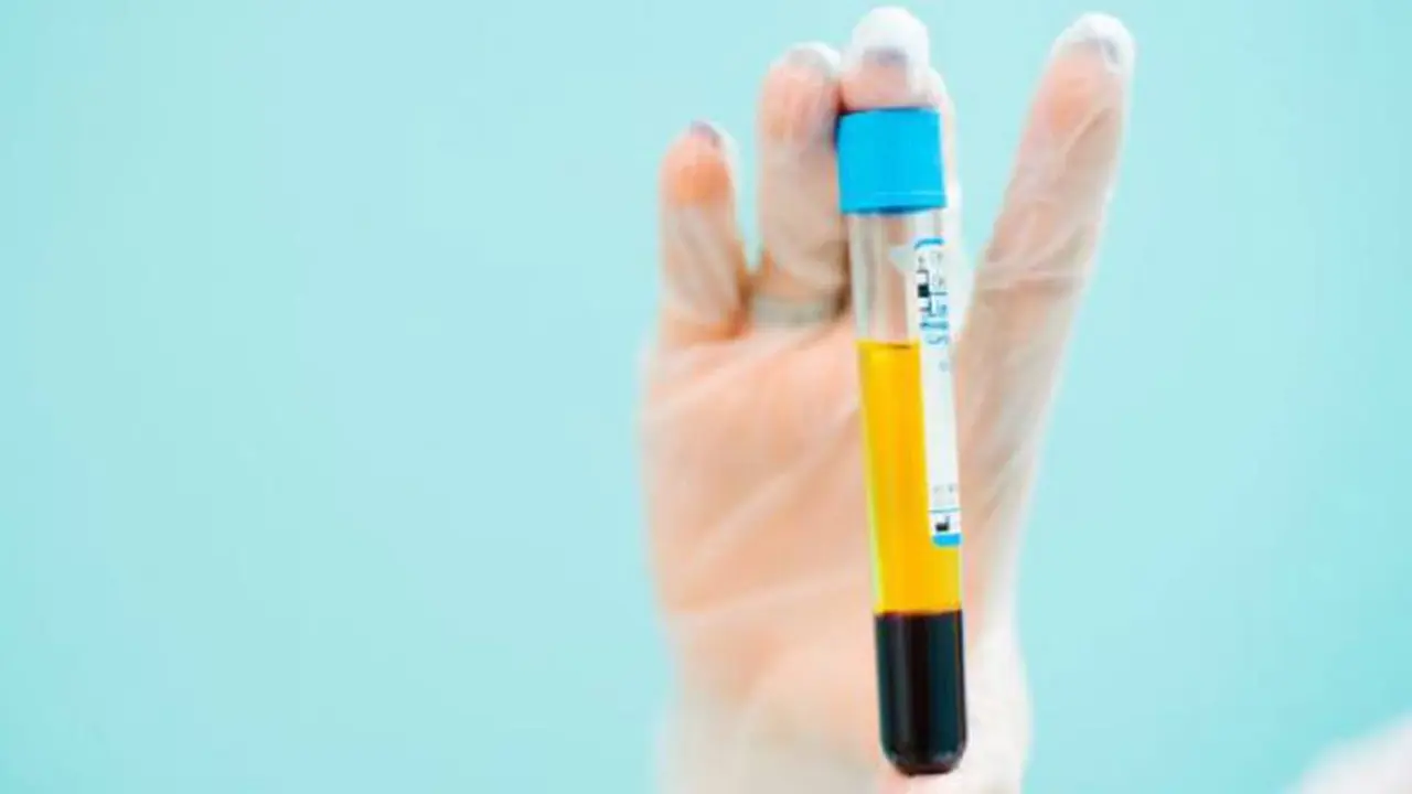 ¿Mito o realidad?: revelan si el plasma realmente sirve para tratar a pacientes con coronavirus