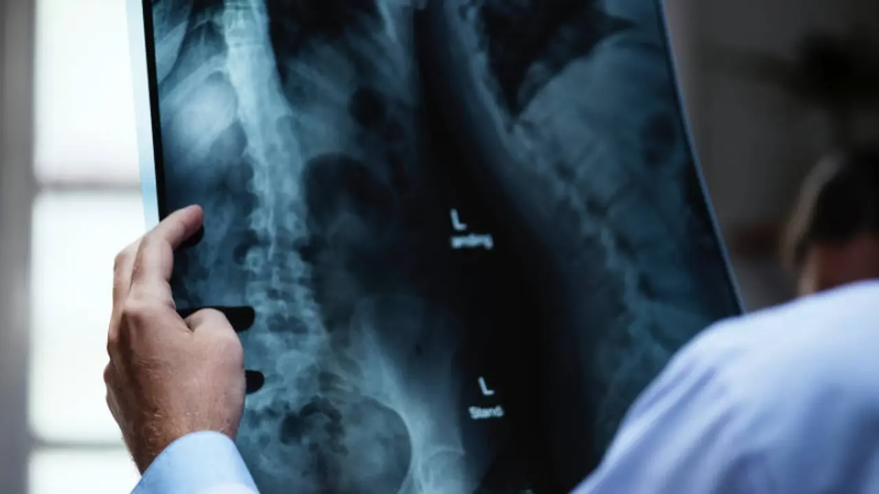 Una radiografía puede costar entre $1.800 y $2.100 en la Ciudad de Buenos Aires