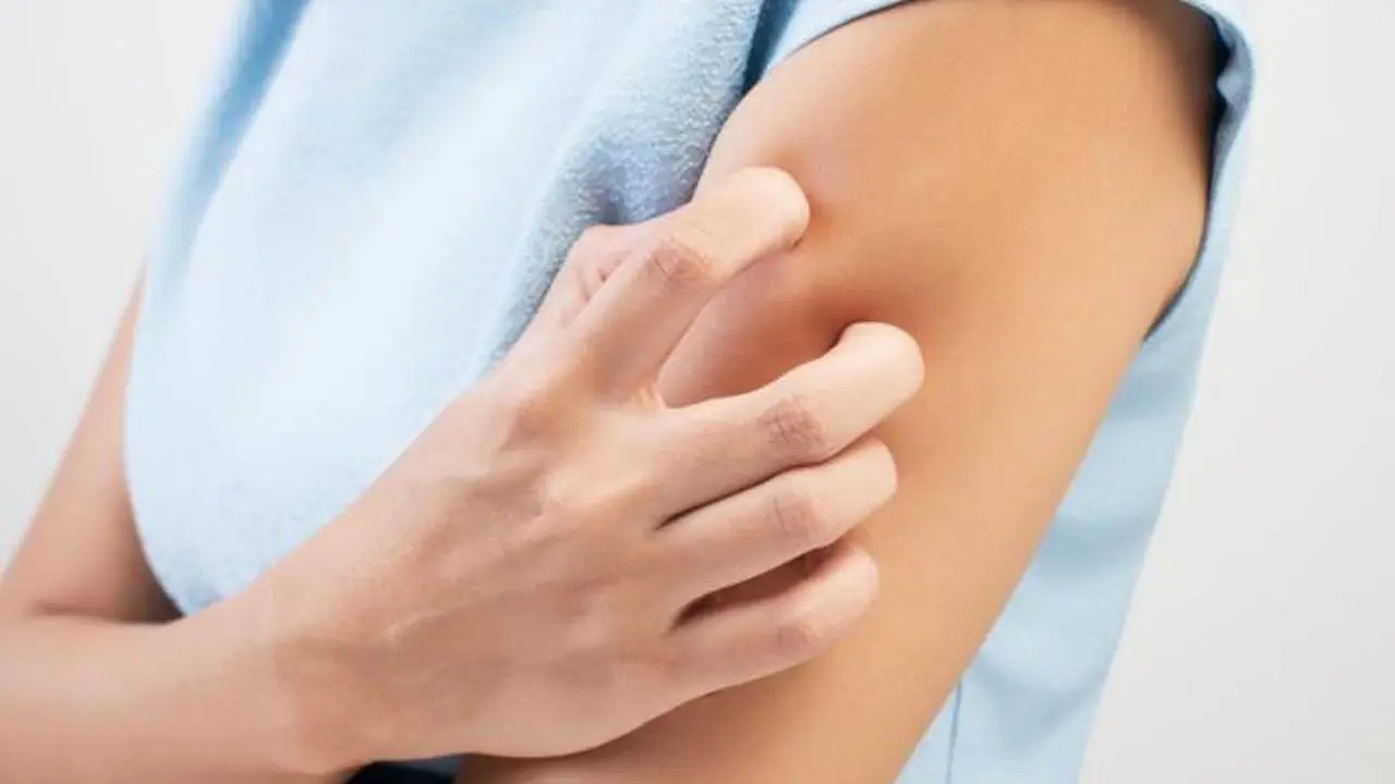 Qué es el "brazo Covid", la peculiar reacción a la vacuna de la empresa Moderna