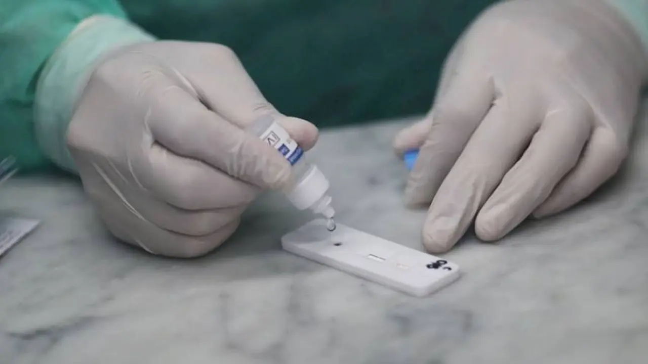 Aprobaron la venta en farmacias de un test rápido de Covid-19, ¿cómo se hace y cuánto sale?