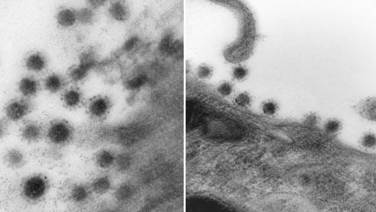 La cepa Delta bajo un microscopio