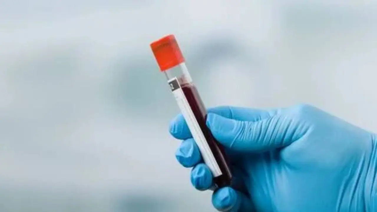 Un análisis de sangre puede ser solicitado para controlar distintos aspectos de la salud