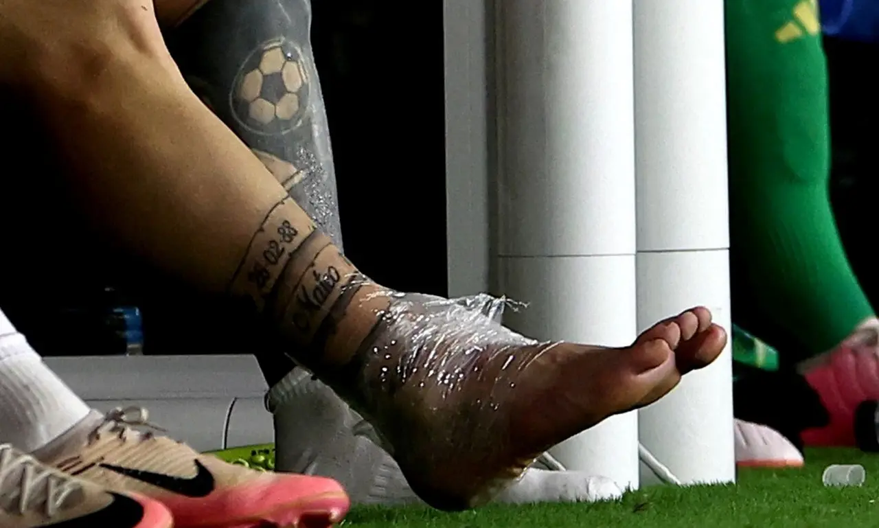 Así quedó el tobillo de Messi durante la final de la Copa América entre Argentina y Colombia