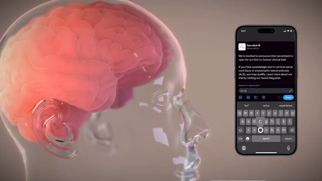 El chip busca conectar cerebros con dispositivos