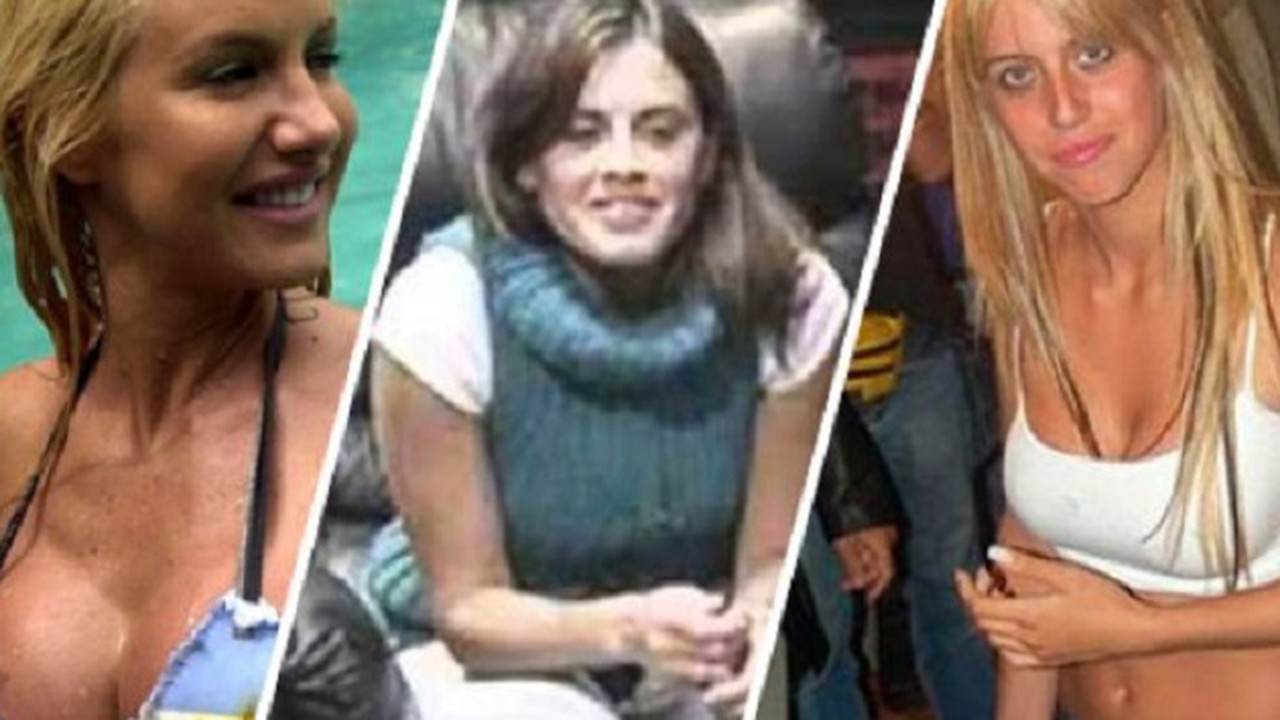 El antes y después de las famosas argentinas: cirugías y deformidades