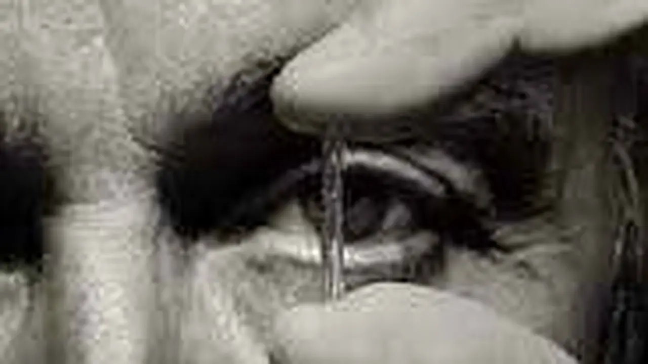 Nuevas técnicas de stent mejoran la angioplastia en EE. UU. y salvan vidas