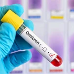 Variante Ómicron: ¿por qué las personas vacunadas se contagian coronavirus?