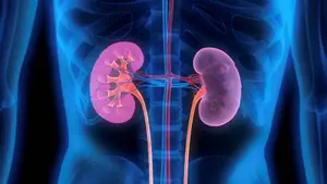 Cáncer Renal: advierten que existe desconocimiento y que se minimizan los síntomas