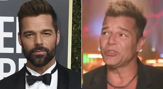Ricky Martin se habría retocado la cara