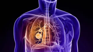 Nueva droga para un tipo de cáncer de pulmón