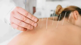 Cómo funciona la acupuntura: el método chino para mitigar el dolor