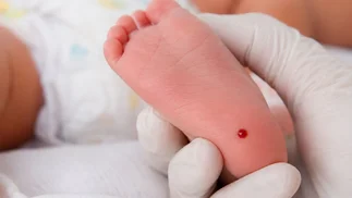 Una gota de sangre del talón del bebé puede evitar una discapacidad irreversible