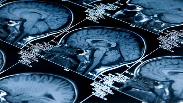 Hackear el cerebro: una inquietante realidad cada vez más cerca de poder concretarse