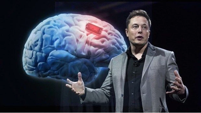 Así funciona Neuralink, el chip cerebral de Elon Musk